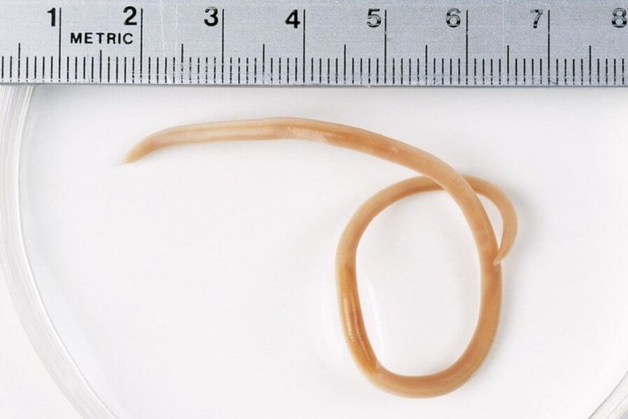 Ascaris je okrogel črv, ki živi v človeškem telesu